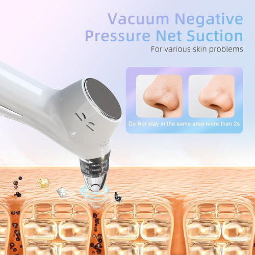 Blackhead Remover Vacuum Facial Pore Cleaner Electric Comedone Whitehead Extractor 5 Suction Probes and 5 Suction Levels Rechargeable Black Heads Remover Tools for Women & Men Facial Skin Care (White)