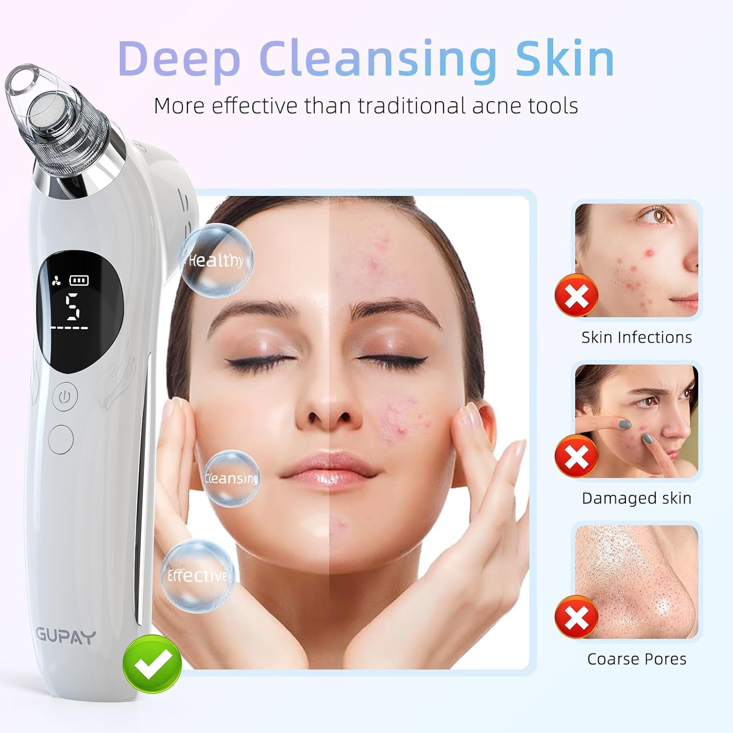 Blackhead Remover Vacuum Facial Pore Cleaner Electric Comedone Whitehead Extractor 5 Suction Probes and 5 Suction Levels Rechargeable Black Heads Remover Tools for Women & Men Facial Skin Care (White)